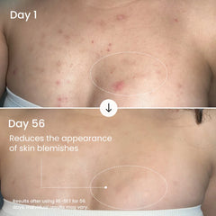RE-SET Balancing Body Serum-RE-SET