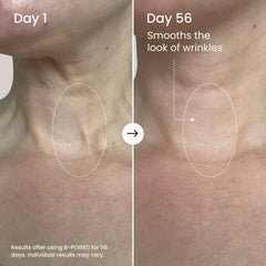 B-POISED Neck & Décolleté Firming Cream-B-POISED