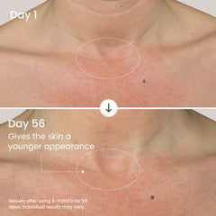 B-POISED Neck & Décolleté Firming Cream-B-POISED