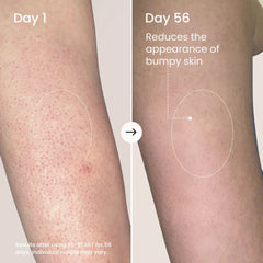 RE-START Resurfacing Body Serum-RE-START