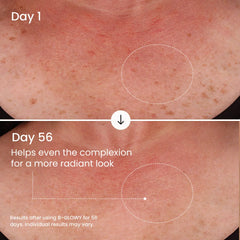 B-GLOWY Brightening Body Serum-B-GLOWY